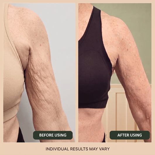 VIɌL™ BODY Anti-Cellulite Massage Oil