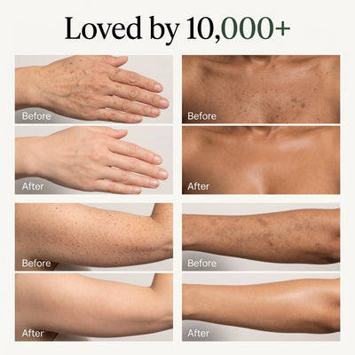 VIɌL™ BODY Anti-Cellulite Massage Oil