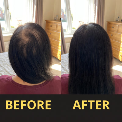 Virelia™ Hair Concealer 50 ml