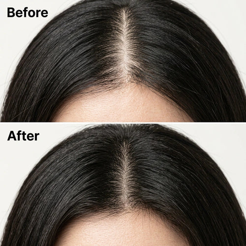 Virelia™ Scalp Revival Bar