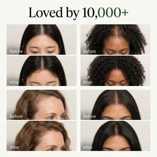 Virelia™ Scalp Revival Bar