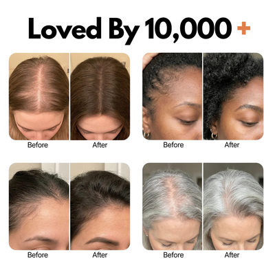 Virelia™ Hair Growth Serum