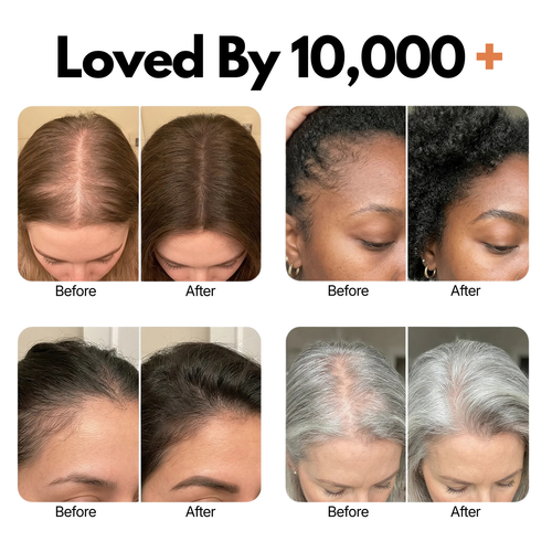 Virelia™ Hair Growth Serum