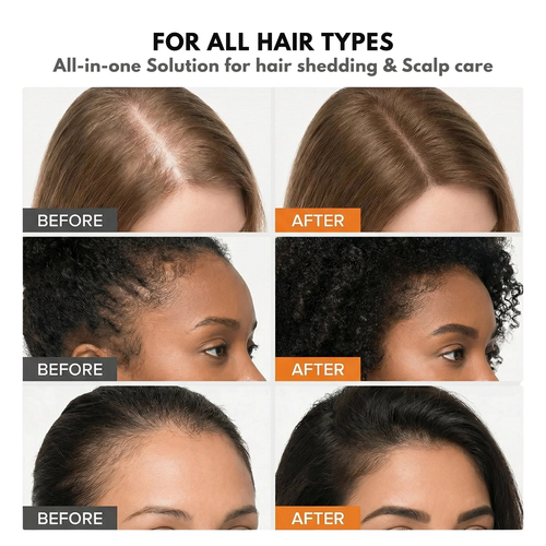 Virelia™ Hair Growth Serum